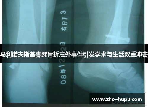 马利诺夫斯基脚踝骨折意外事件引发学术与生活双重冲击